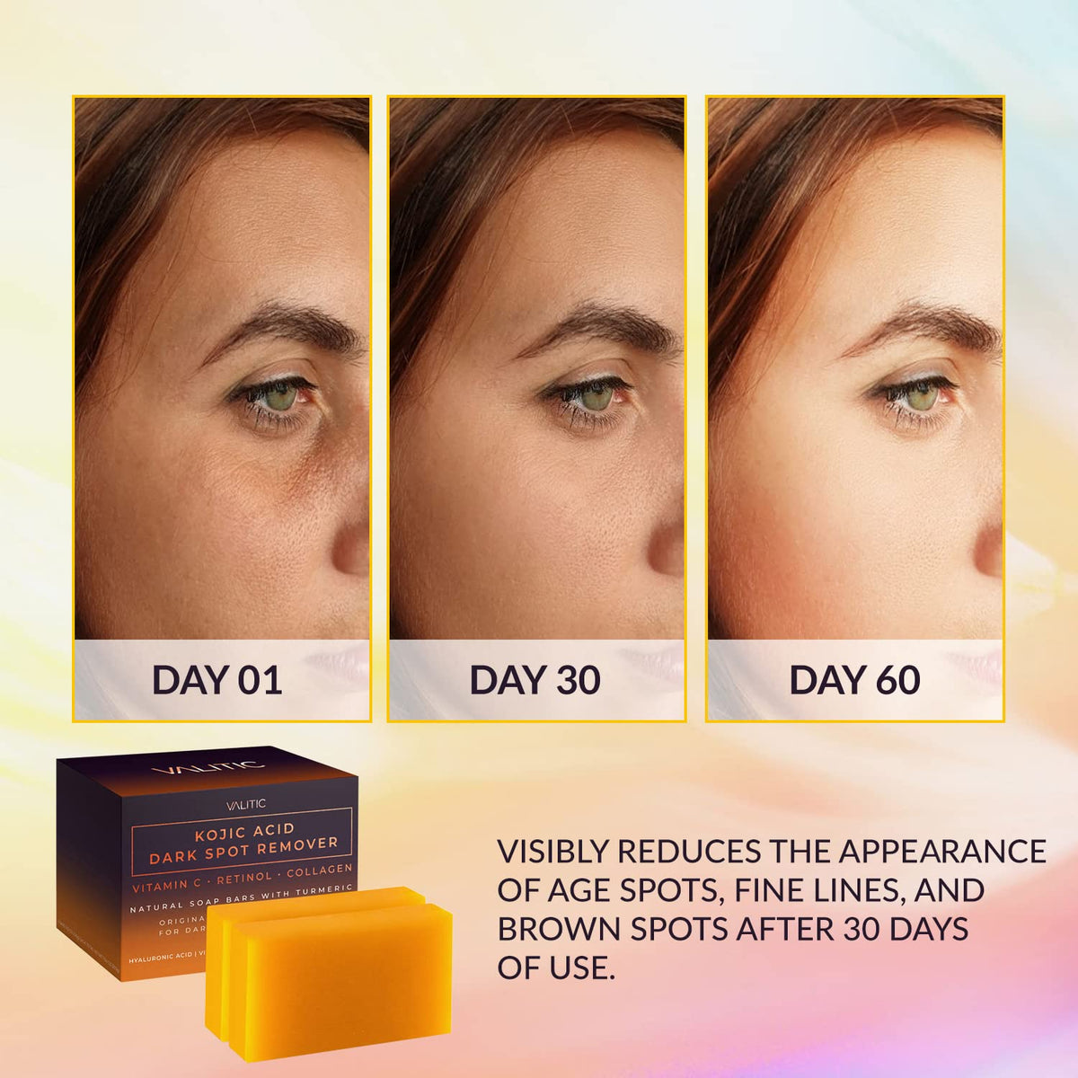 VALITIC KOJIC ACID DARK SPOT REMOVER BAR FACE CLEANSER