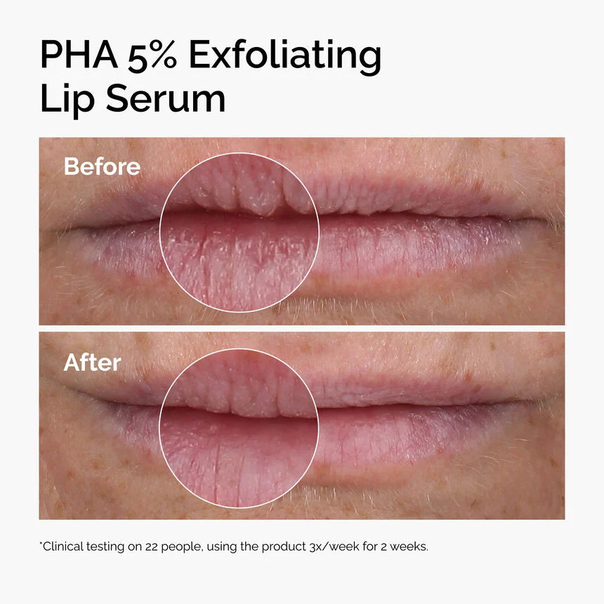 THE ORDINARY PHA 5% EXFOLIATING LIP TREATMENT