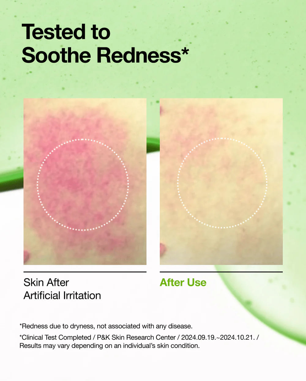 ANUA AZELAINSÄURE 10 HYALURON RÖTUNGSMINDERNDES BERUHIGENDES SERUM